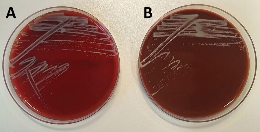 Small white-gray colonies of Auritidibacter ignavus in a sample from a chronic ear infection patient, Germany. Colonies are shown after 2 days of incubation at 37°C on tryptic soy blood agar (A) and chocolate agar (B).