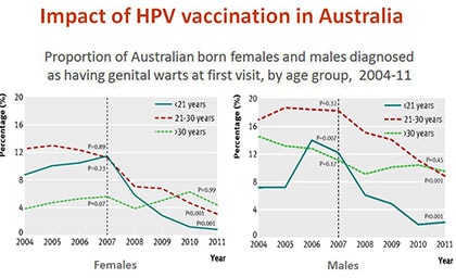 Impact of HPV vaccination in Australia.