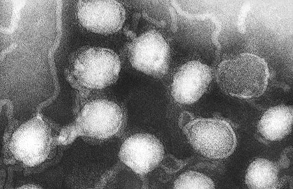 Negative-stained transmission electron microscopic (TEM) image revealed the presence of La Crosse (LAC) encephalitis virus ribonucleoprotein particles.