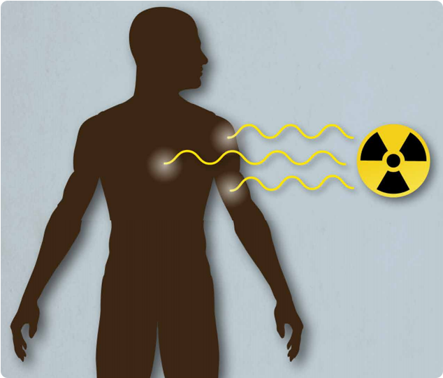 vector graphic of a person figure with radiation sources