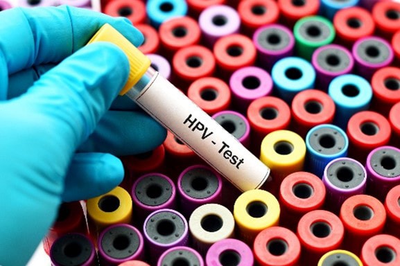 HPV test tube