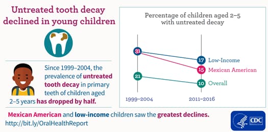 Untreated tooth decay declined in young children