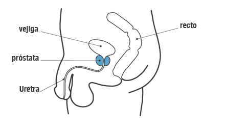 Diagrama de la pr&oacute;stata, la vejiga, el recto y la uretra