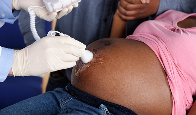 Pregnant woman getting an ultrasound.
