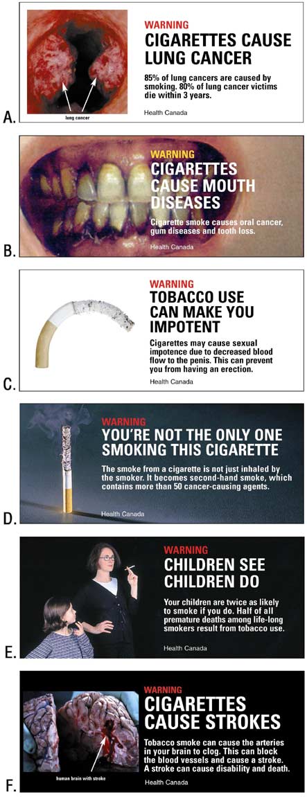 This is a series of six cigarette warning labels, A through F. Label A shows lungs with lung cancer and states, �Warning: Cigarettes cause lung cancer.� Label B displays an open mouth with dental problems and gum disease and the text, �Warning: Cigarettes cause mouth diseases.� Label C shows a curved, limp cigarette and the text, �Warning: Tobacco use can make you impotent.� Label D shows a burning cigarette standing on end with a caption about secondhand smoke that states, �Warning: You�re not the only one smoking this cigarette.� Label E shows a mother with a female child approximately aged 8 years with the text, �Warning: Children see, children do�. Label F displays a picture of a human brain following a stroke and the statement, �Warning: Cigarettes cause strokes.�