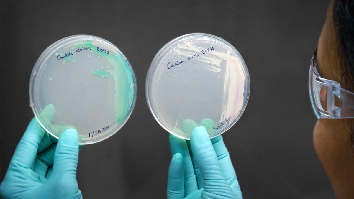 A lab scientist hold two closed petri dishes with strains of candida auris