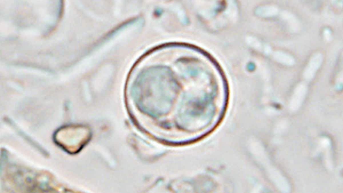 Three of a Kind: CDC Researchers Find Cyclospora is Not Just a Single ...