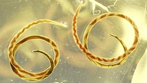 Angiostrongylus adult females