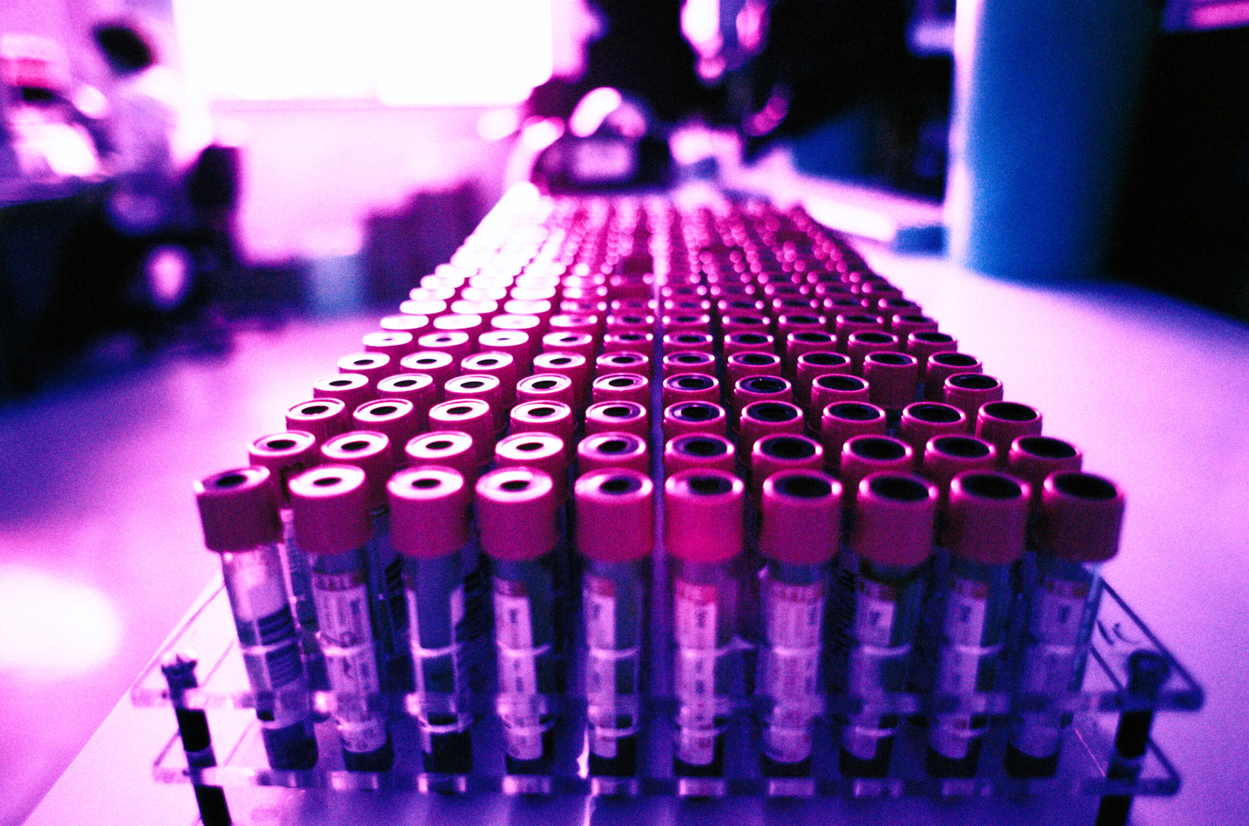 Blood vials in rack