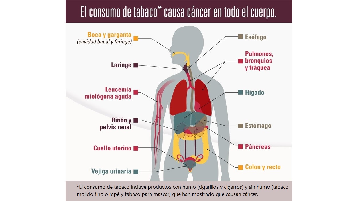 El consumo de tabaco causa cáncer en todo el cuerpo. El consumo de tabaco incluye productos con humo (cigarrillos y cigarros) y sin humo (tabaco molido fino o rapé y tabaco para mascar) que, hasta la fecha, han mostrado que causan cáncer.
