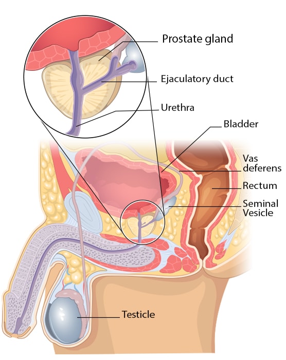 What Is Prostate Cancer Cdc