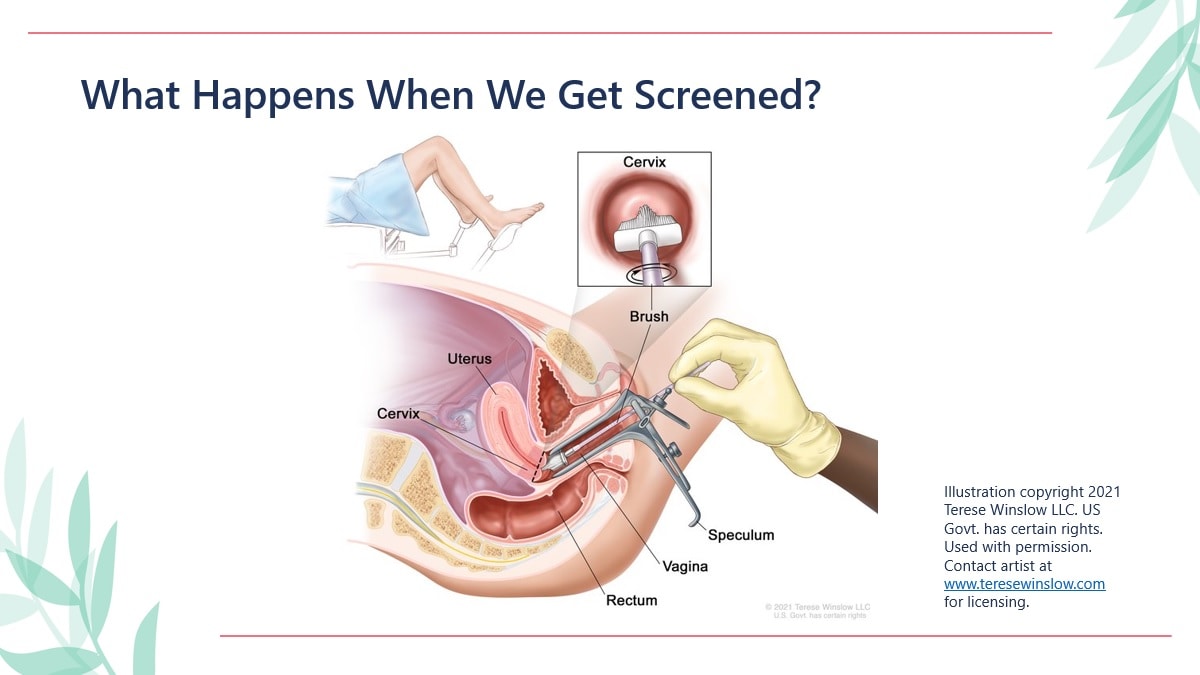 Cervical cancer screening test diagram