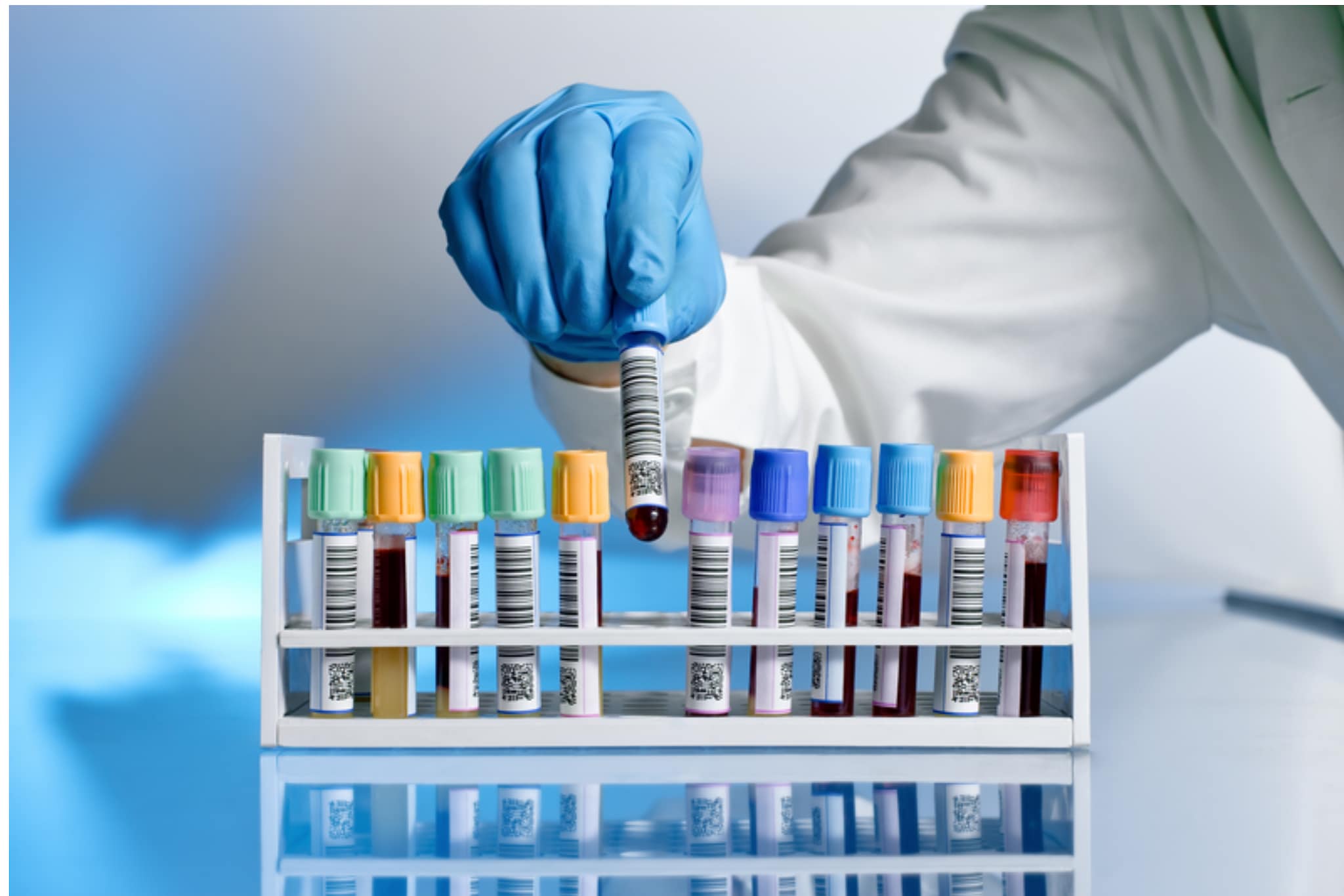 A photo of a lab scientist processing samples.