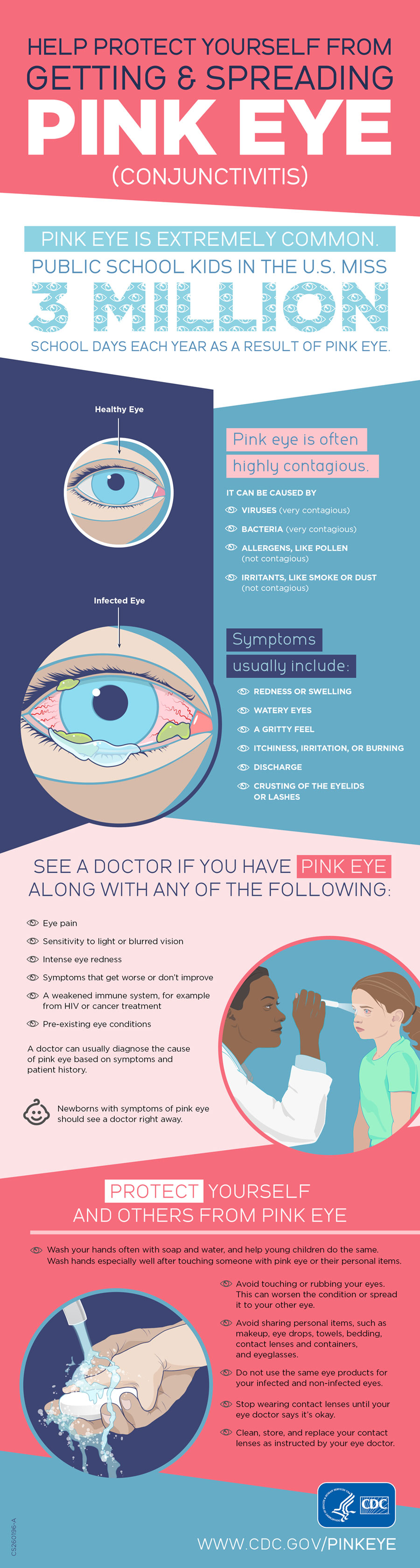 Pink eye: What it is and how to treat it