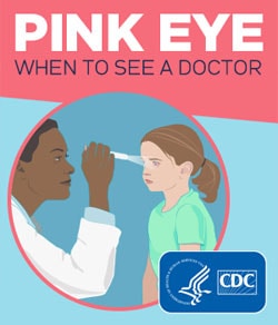 Conjunctivitis (Pinkeye) - Doctors in Service Clinic