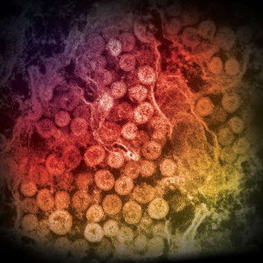 electron microscope images color virus