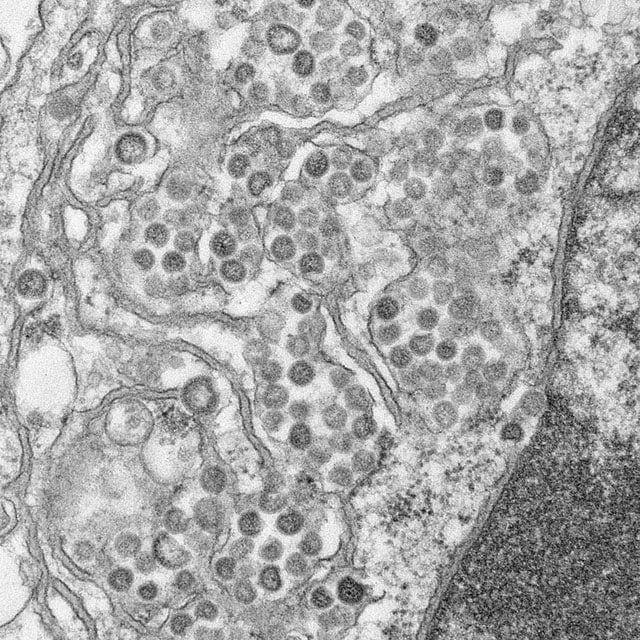 Real Coronavirus Images Under Microscope
