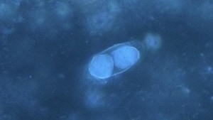 Immature oocysts of Cystoisospora belli viewed by UV fluorescence microscopy.