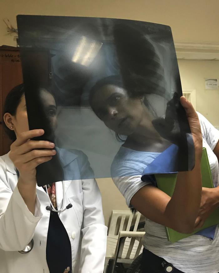 Doctors examining an X-ray of a dengue patient.