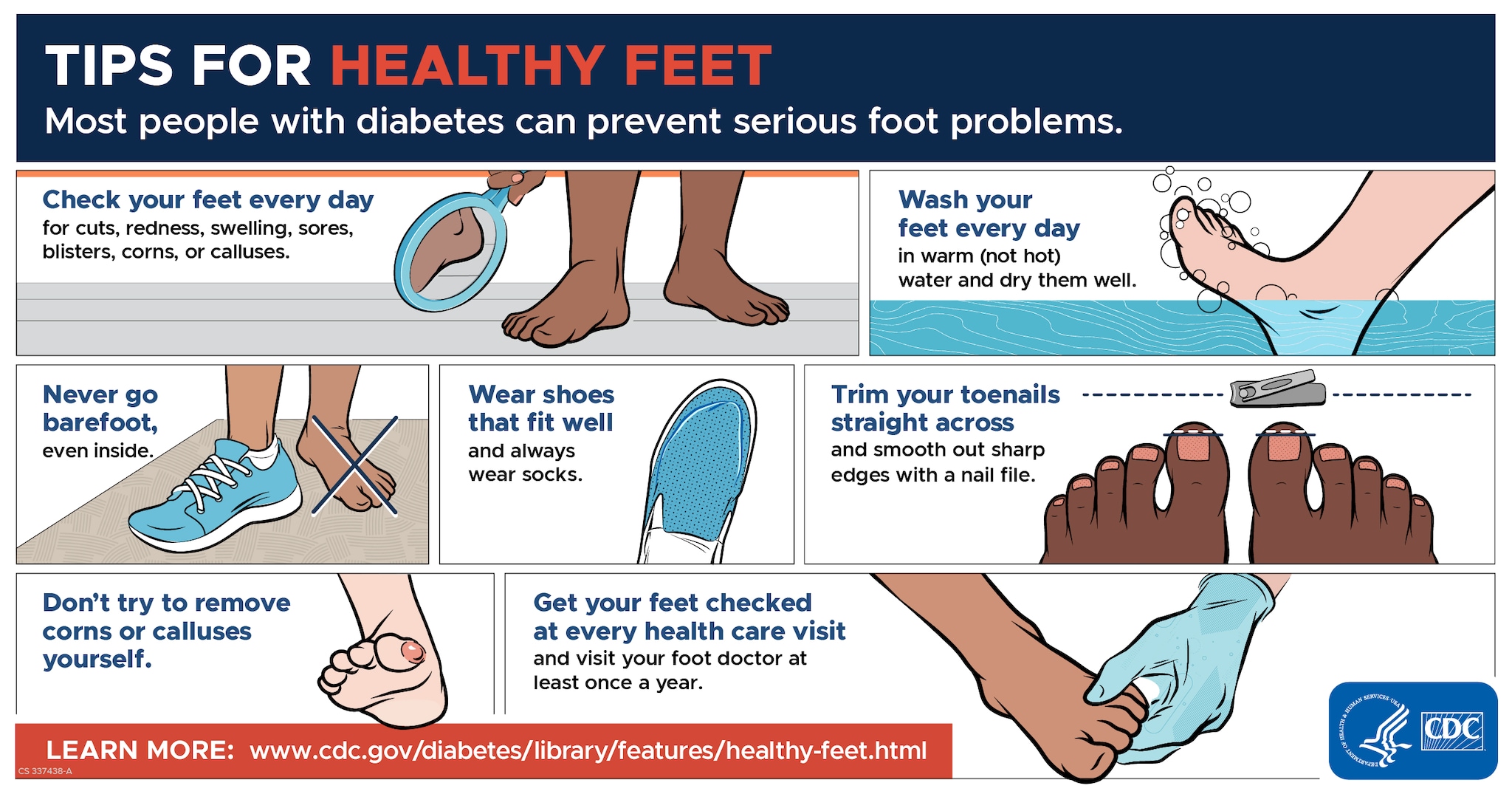 Tips for Healthy Feet infographic