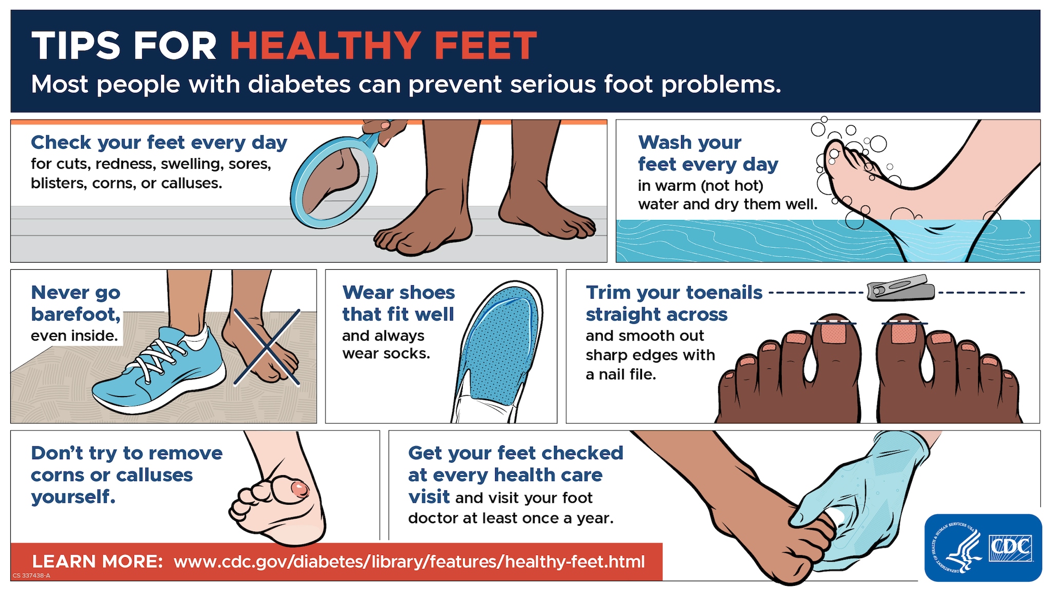 Diabetic foot care advice
