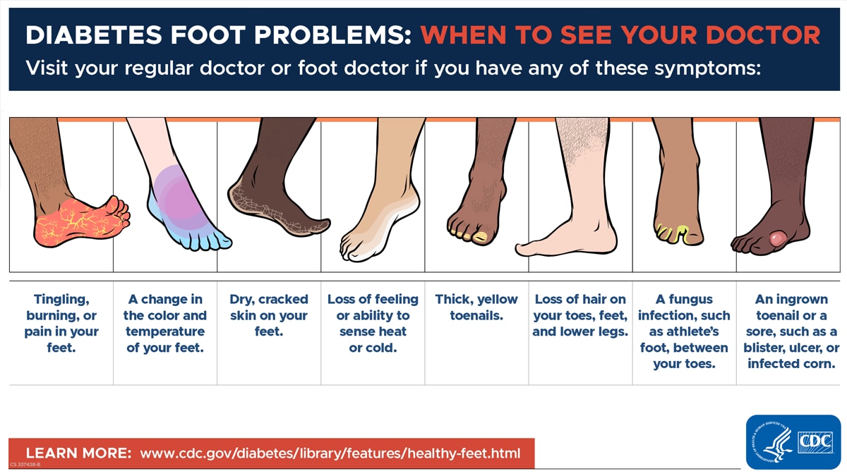 Diabetes Foot Problems - Visit your regular doctor or foot doctor if you have any of these symptoms.