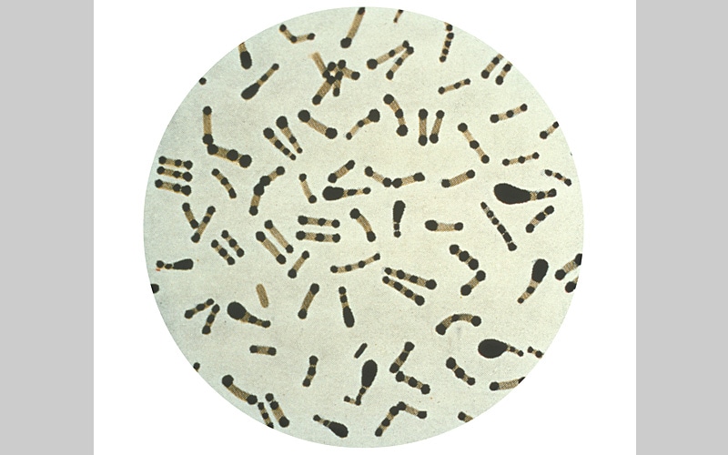 Photomicrograph of Corynebacterium diphtheriae taken from an 18 hour culture, and using Albert's stain.