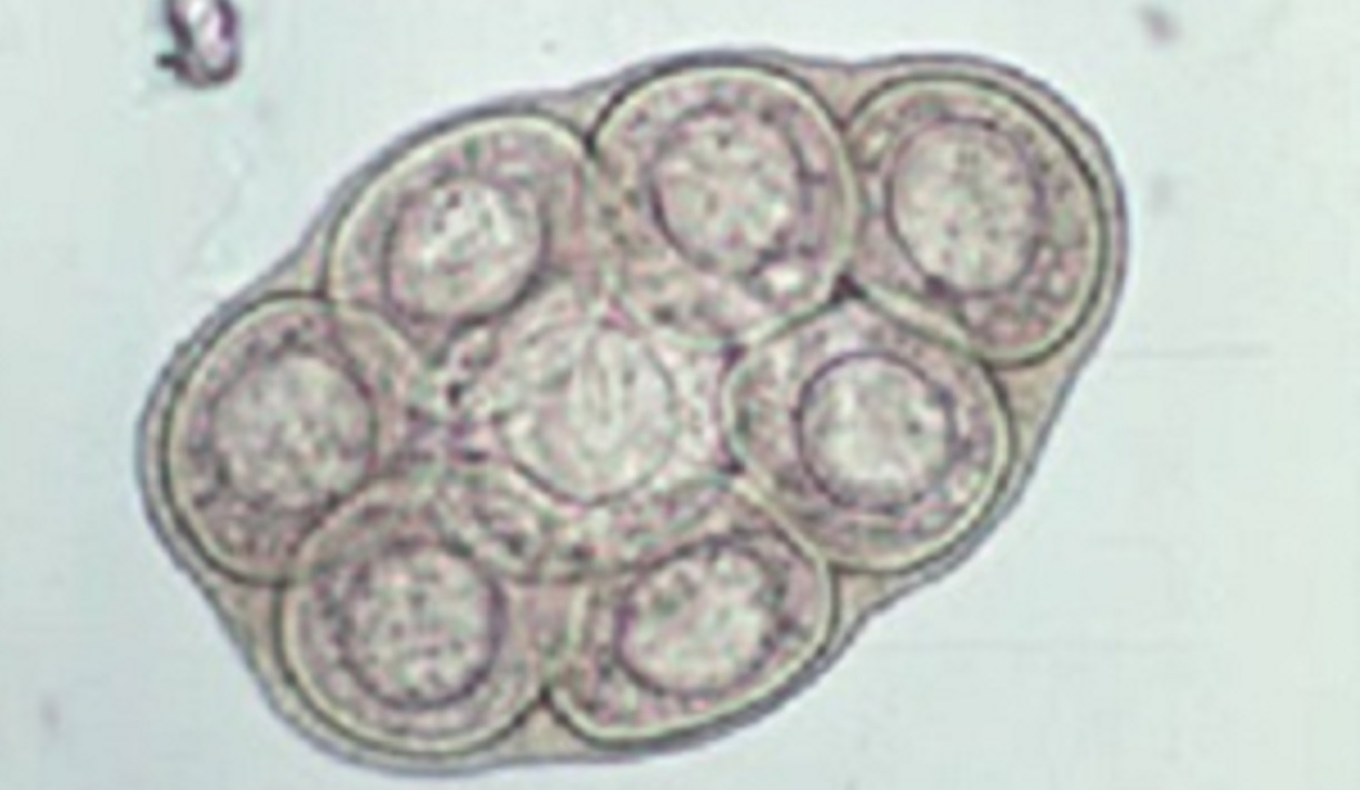 Microscopic view of  dipylidium parasite