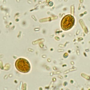 parasite in stool sample