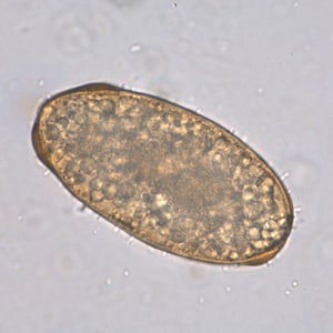 ascaris lumbricoides larvae
