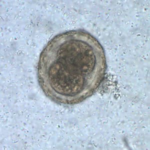 Ascaris Lumbricoides Fertilized Egg