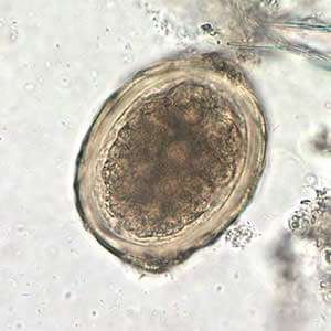 ascaris lumbricoides eggs with mammillations