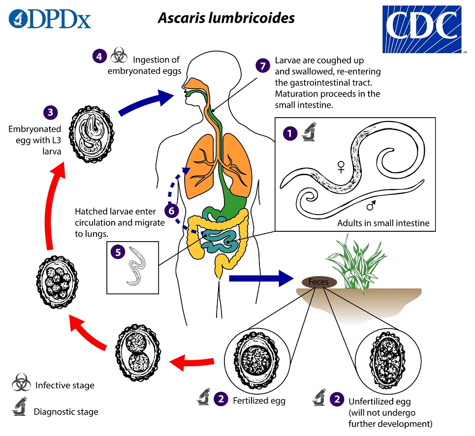 Ascariasis_LifeCycle_19 Life cycle of ascariasis