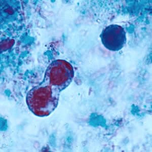 Blastocystis Hominis Trichrome Stain