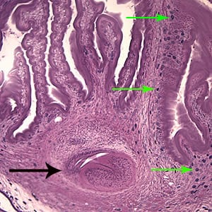 CDC - DPDx - Cysticercosis