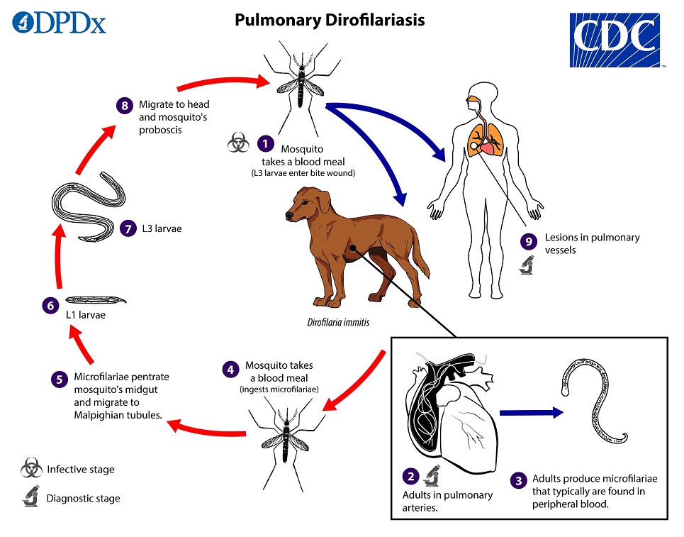 Pulmonary Dirofilariasis