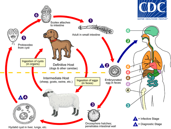 cdc-dpdx-echinococcosis