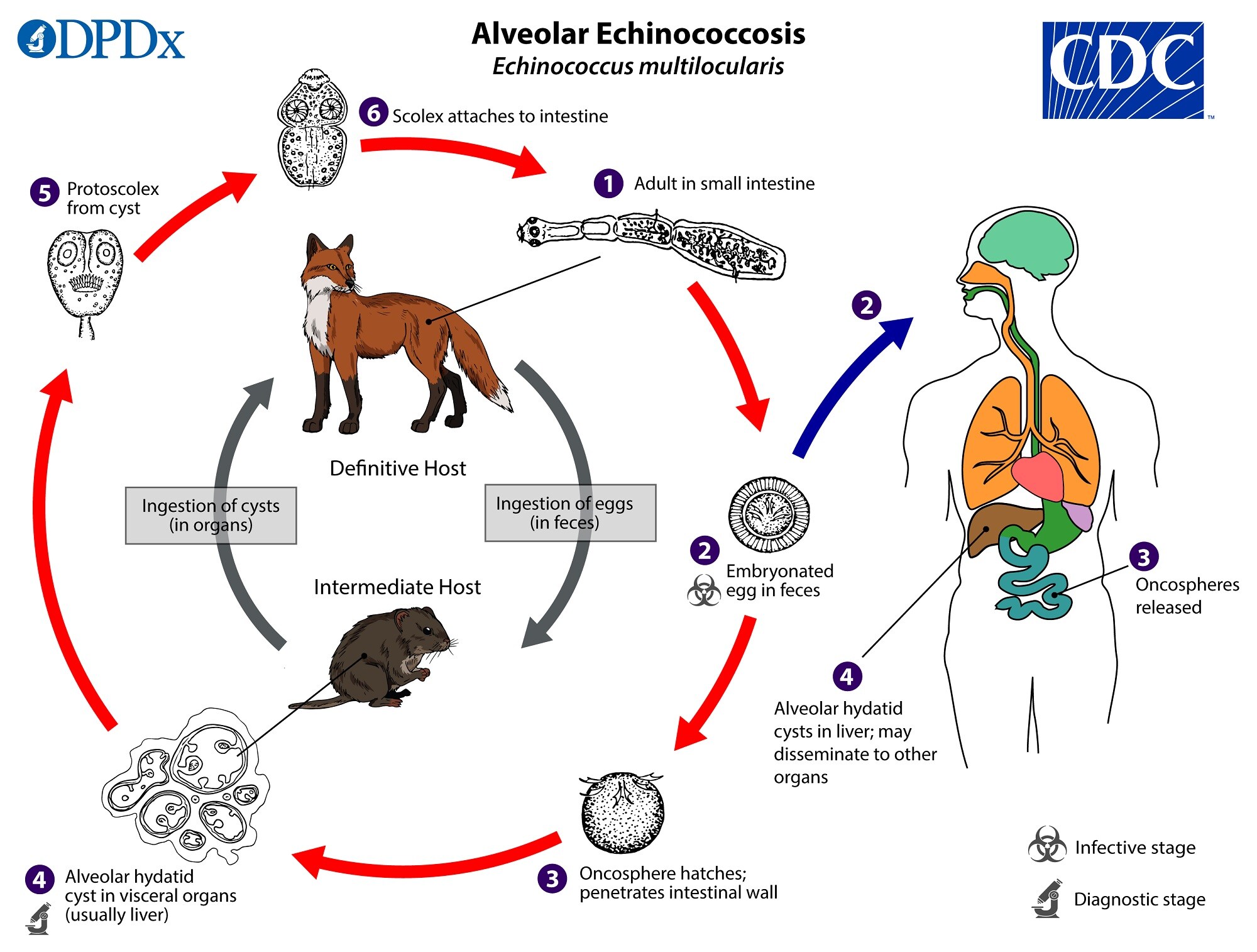 CDC DPDx Echinococcosis