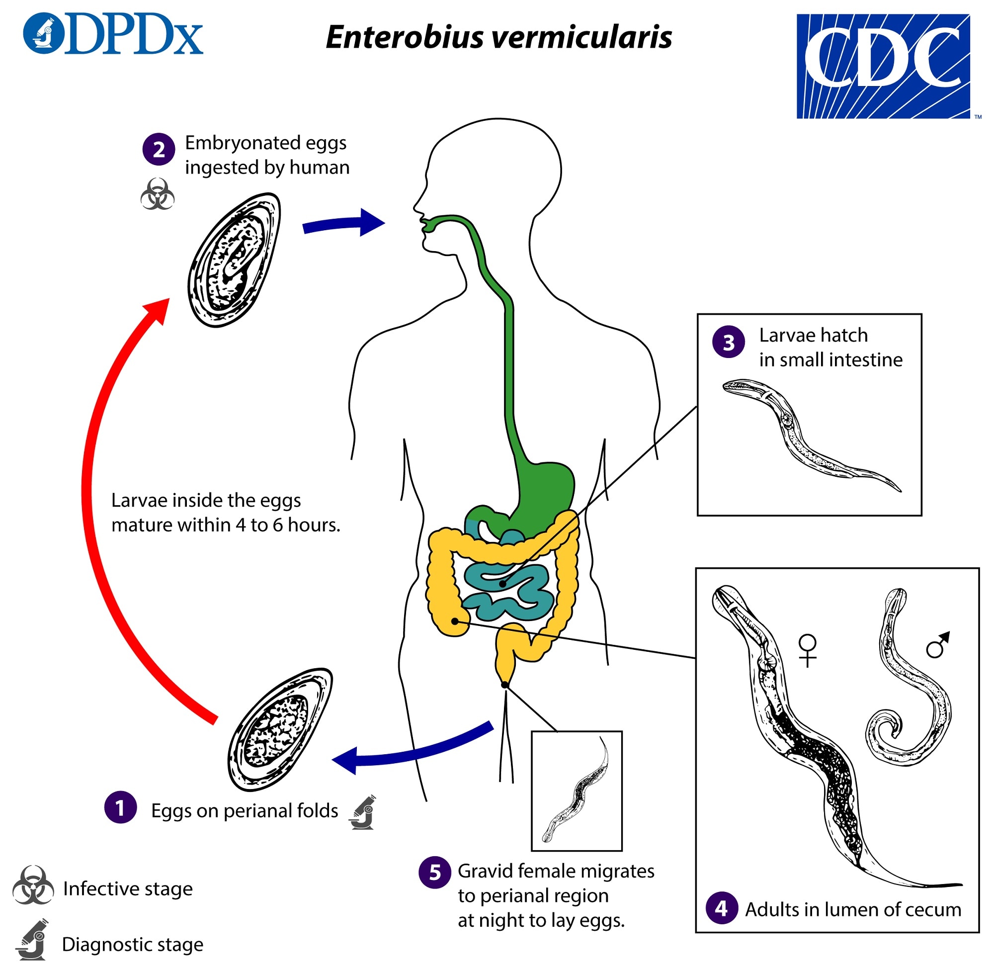 enterobius vermicularis in urine treatment