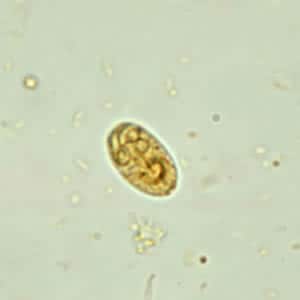 giardia cyst in fecal float