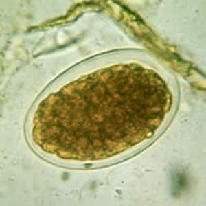 CDC - DPDx - Intestinal Hookworm