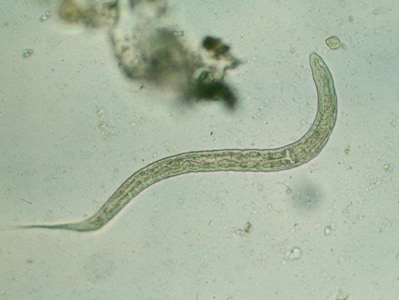 necator americanus rhabditiform larvae