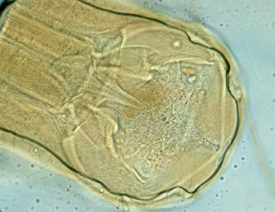 necator americanus rhabditiform larvae