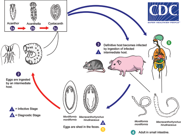 CDC - DPDx - Acanthocephaliasis