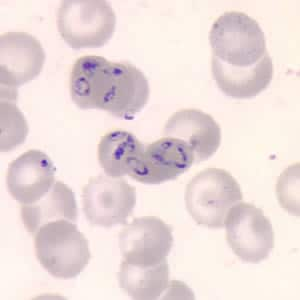 CDC - DPDx - Babesiosis