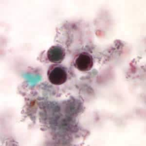 CDC - DPDx - Blastocystis