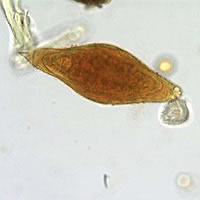 January - 2005 - Case #148