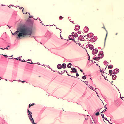 February - 2005 - Case #150