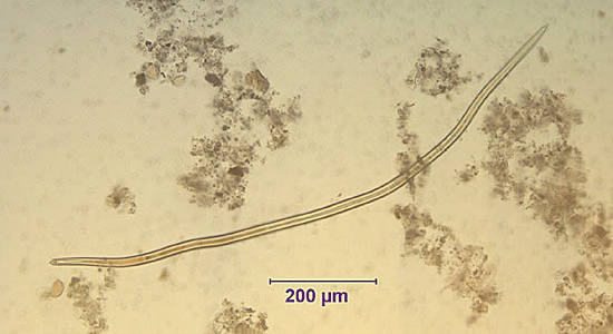 May - 2005 - Case #155