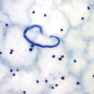 August - 2005 - Case #161